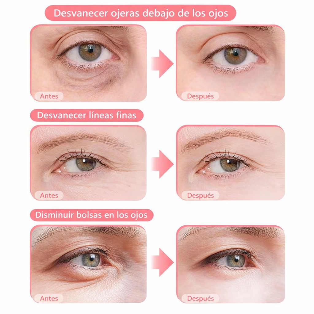 Gafas antiojeras y bolsas con Luz Roja